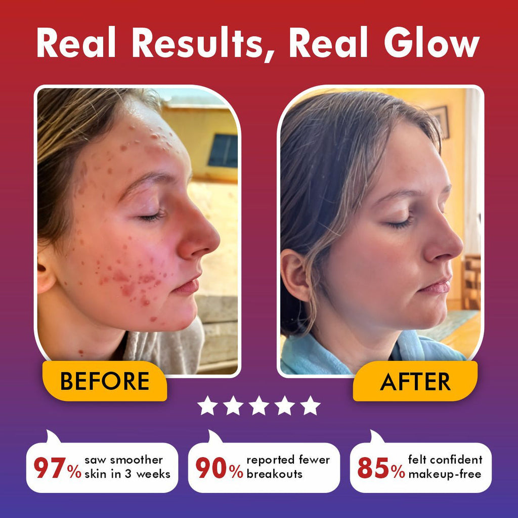 LumaSkin Pro 2.0 | LED Facial Mask