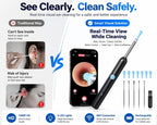Earwax Removal Kit – Smart HD Visual Ear Cleaning Tool with Camera/مجموعة إزالة شمع الأذن